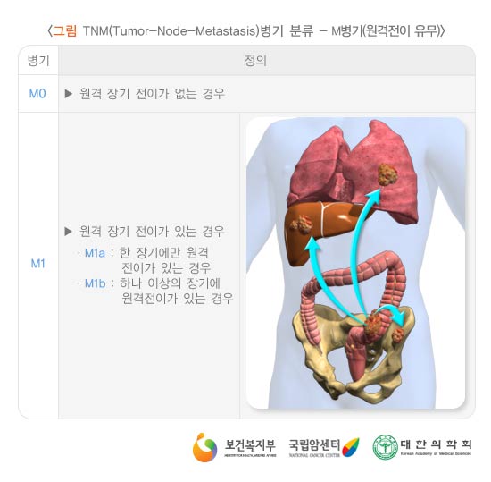 TNM(Tumor-Node-Metastasis)  з-M( )