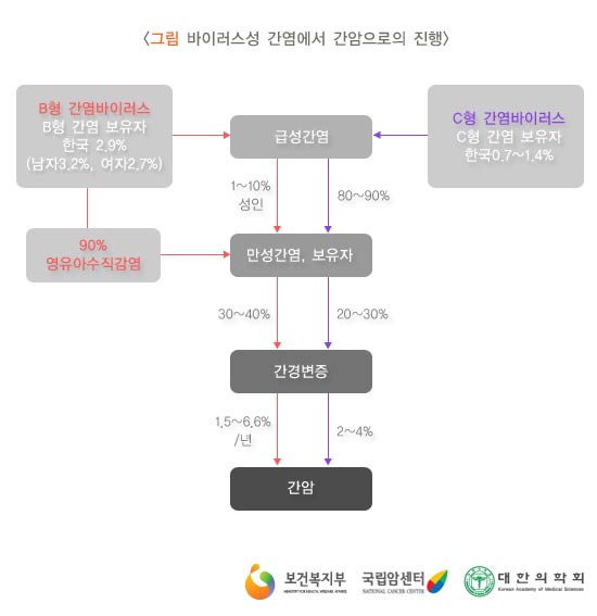 바이러스성 간염에서 간암으로의 진행