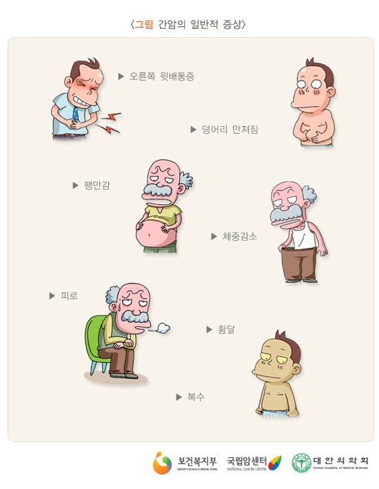 간암의 일반적 증상
