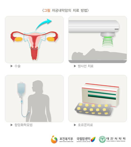 자궁내막암의 치료 방법